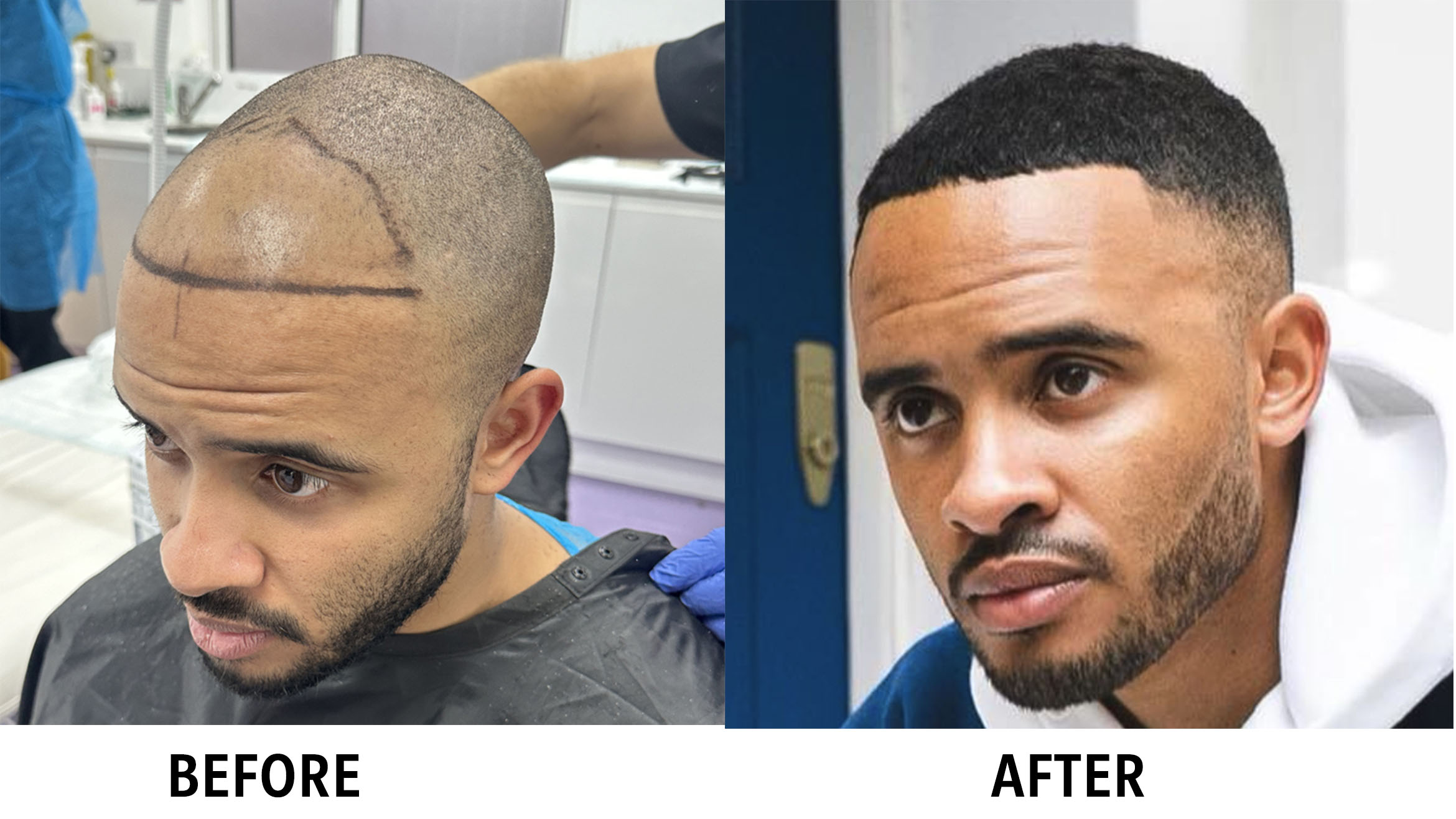 Natural Hair Solutions for Men in New York